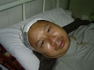 Zhao Xin on his hospital bed. (Huang Qi)