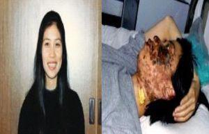 Gao Rongrong's photo before her death. The right photo was taken 10 days after her disfiguration. (<a href="http://Minghui.net">Minghui.net</a>)