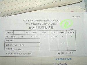 A 'kidney match" test was done at the Zhongshan Hospital on May 23, 2002. The listed doctor and Hospital on the documents were "The Internal Medicine Department, Zhu Lanying." (This photo was provided by the victim's family)