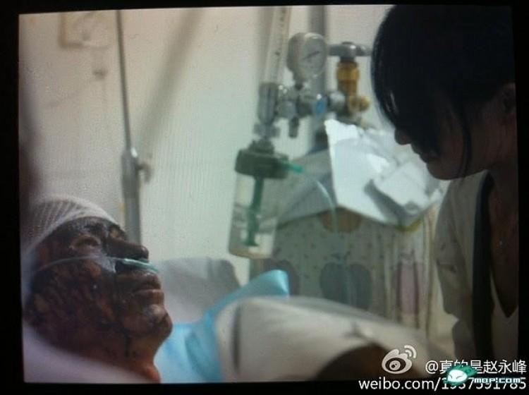 <a><img src="https://www.theepochtimes.com/assets/uploads/2015/09/1109072351232431.jpg" alt="Duan, a peddler, beaten for a chivalrous assist in Kunming, China. (Posted to Weibo.com)" title="Duan, a peddler, beaten for a chivalrous assist in Kunming, China. (Posted to Weibo.com)" width="320" class="size-medium wp-image-1798042"/></a>