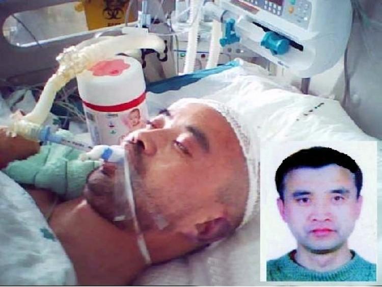 <a><img src="https://www.theepochtimes.com/assets/uploads/2015/09/2011-3-15-yuyungang-combined2_medium.jpg" alt="HOSPITALIZED: Mr. Yu Yungang, 48, lying unconscious in the intensive care unit of a hospital after a round of intense torture lead to skull damage. Hospital staff was unable to save him, and he died soon after this photograph was taken. (Falun Dafa Information Center)" title="HOSPITALIZED: Mr. Yu Yungang, 48, lying unconscious in the intensive care unit of a hospital after a round of intense torture lead to skull damage. Hospital staff was unable to save him, and he died soon after this photograph was taken. (Falun Dafa Information Center)" width="250" class="size-medium wp-image-1800673"/></a>