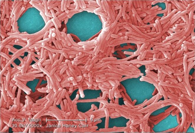 A colorized scanning electron micrograph (SEM) of Legionella pneumophila bacteria. (Janice Haney Carr/CDC/Public Domain)