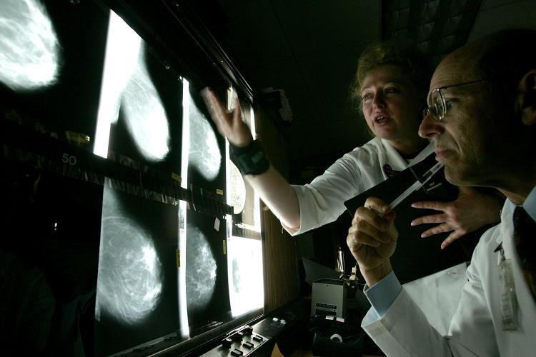 Doctors look at films of breast x-rays. (Justin Sullivan/Getty Images)