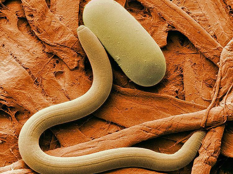 <a><img src="https://www.theepochtimes.com/assets/uploads/2015/09/Soybean_cyst_nematode_and_egg_SEM.jpg" alt="ROUNDWORM: Photo of a Soybean cyst nematode and its egg, magnified 1,000X. A yellow dye used in staining misfolded proteins associated to Alzheimer's disease can boost the lifespan of roundworms by 78 percent. (Agricultural Research Service)" title="ROUNDWORM: Photo of a Soybean cyst nematode and its egg, magnified 1,000X. A yellow dye used in staining misfolded proteins associated to Alzheimer's disease can boost the lifespan of roundworms by 78 percent. (Agricultural Research Service)" width="320" class="size-medium wp-image-1805653"/></a>