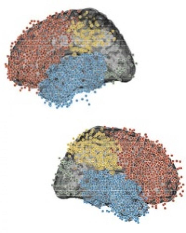 <a><img class="size-medium wp-image-1800727" title="A diagram of electrode placements. (University of Pennsylvania)" src="https://www.theepochtimes.com/assets/uploads/2015/09/electrodes.jpg" alt="A diagram of electrode placements. (University of Pennsylvania)" width="250"/></a>