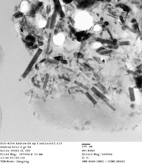 Carbon inside a lung cell vacuole takes the form of nanotubes (rods) and nanoparticles (black clumps). (Courtesy of Fathi Moussa/Paris-Saclay University)