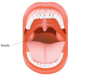 The tonsils are an important part of the immune system. (ttsz/iStock)