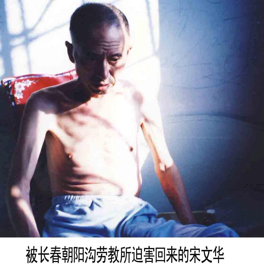 Song Wenhua after released from labor camp. (Minghui.org)