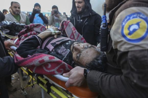 An injured Syrian arrives at a refugee camp in Rashidin, near Idlib, Syria, after was evacuated from the embattled Syrian city of Aleppo during the ceasefire on Dec. 20, 2016. (AP Photo)