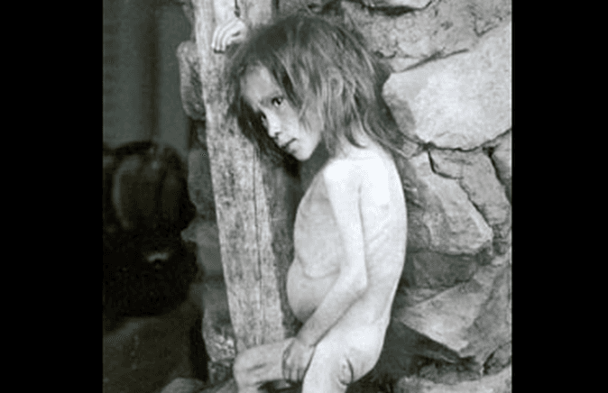 Starving Russian girl in Buguruslan, 1921 (Public Domain)
