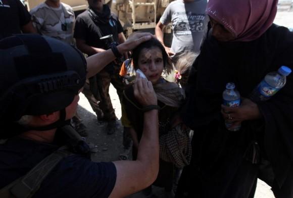 A wounded displaced Iraqi girl who fled from clashes is seen in the Old City of Mosul, Iraq June 24, 2017. (Reuters/Azad Lashkari)