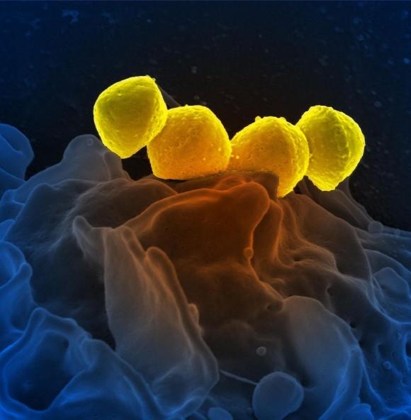 Scanning electron micrograph of group A streptococcus (Streptococcus pyogenes) bacteria on primary human neutrophil. This is the most common type of flesh-eating bacteria. ( NIAID/CC BY 2.0)