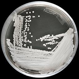A strain of <em>Candida auris</em> cultured in a petri dish at CDC. (CDC)