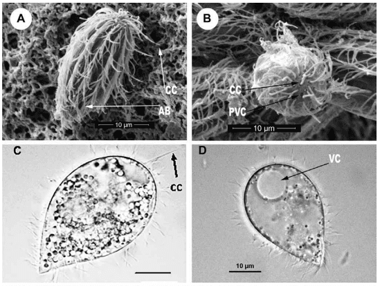 Scanning electron microscope showing the ciliate protozoan M. avidus (Medina et al., 2016 [http://revistasinvestigacion.unmsm.edu.pe/index.php/rpb/article/view/12861/11482])