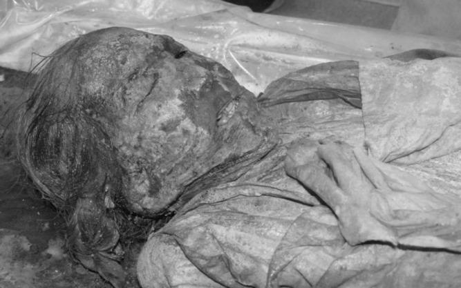 A female Korean mummy  from 350 years ago. (<a href="https://www.ncbi.nlm.nih.gov/pmc/articles/PMC4712574/">ncbi.nlm.nih.gov</a>)