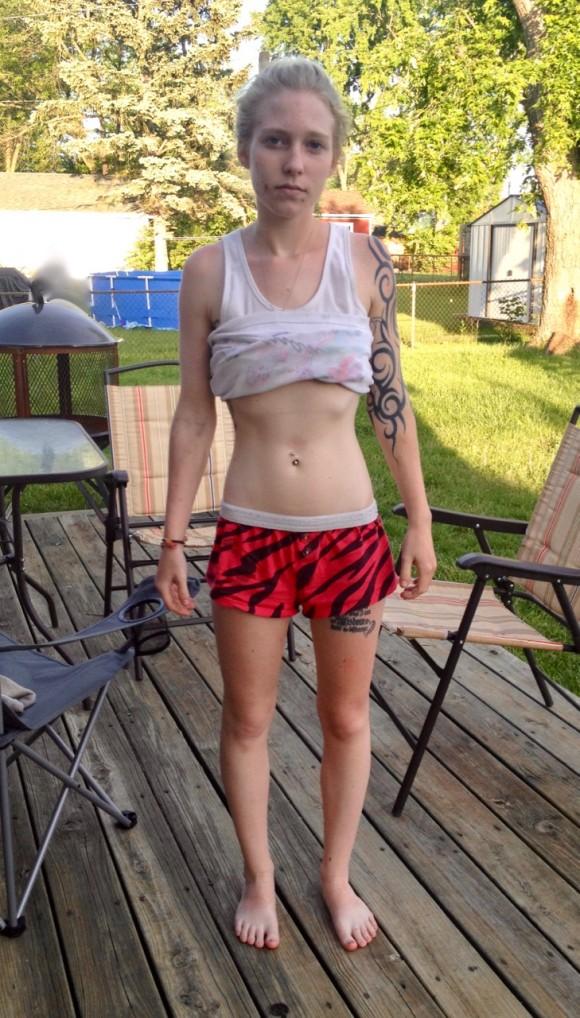April Erion's "before recovery" photo, taken in her backyard in Ohio at the point when she decided she wanted help for her addiction, on May 25, 2014. (Courtesy of Lori Erion)