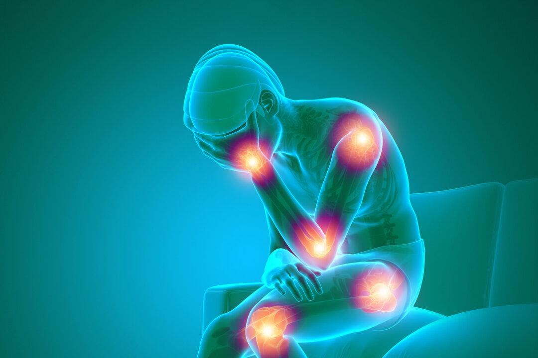 psoriatic arthritis The Epoch Times