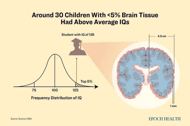 Can Consciousness Exist Without a Brain? | The Epoch Times