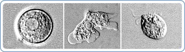 This combo of images provided by the Center for Disease Control shows the Naegleria fowleri amoeba in the cyst stage, left, trophozoite stage, center, and the flagellated stage, right. (AP Photo/Center For Disease Control)