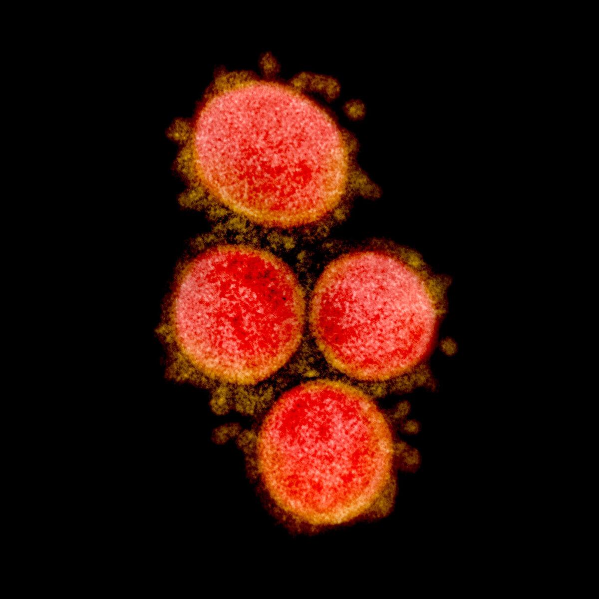 Transmission electron micrograph of the CCP virus isolated from a patient, published on March 10, 2020. (NIAID)