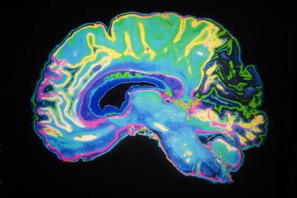 A colorful image of a human brain is seen as part of a report released by a UCLA-led team of scientists that reveals why sleep is vital to health and healing. (Courtesy of UCLA/Daisy Daisy/Shutterstock)