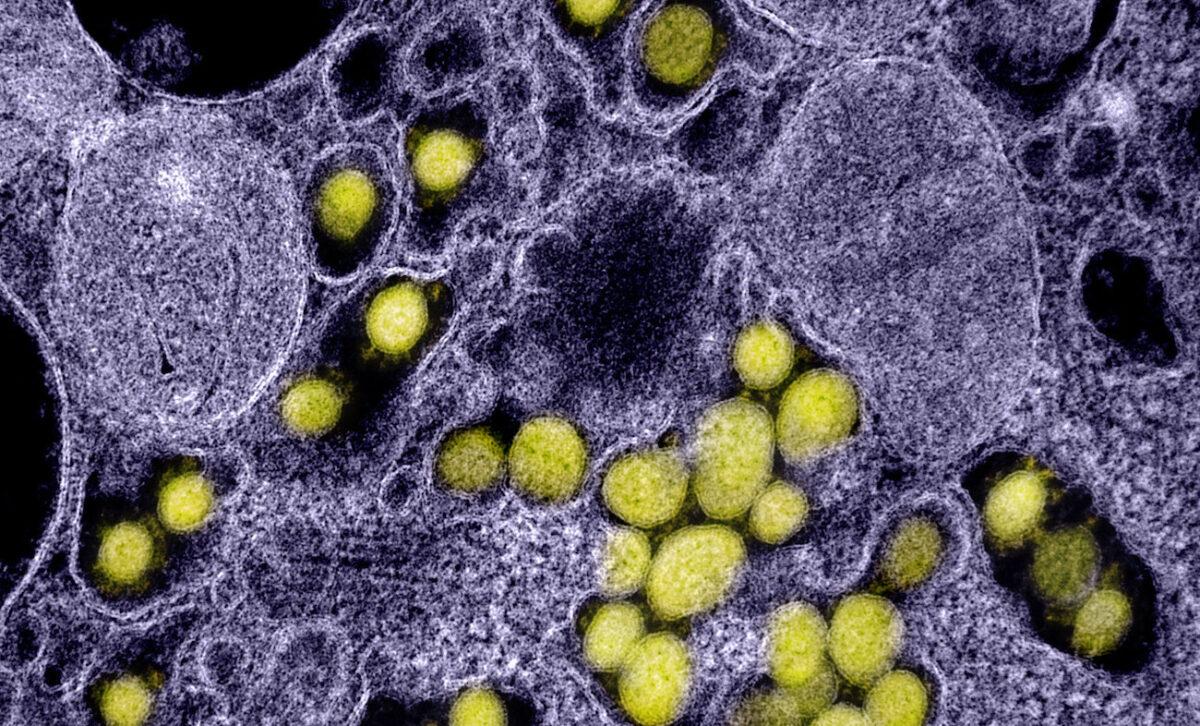 A transmission electron micrograph shows SARS-CoV-2 virus particles isolated from a patient. (NIAID)