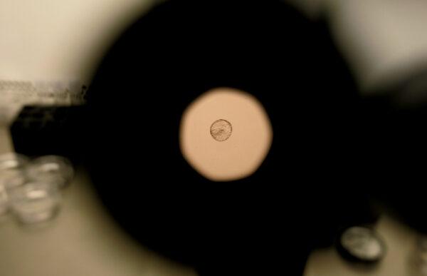 A donated human embryo is seen through a microscope at the La Jolla IVF Clinic in La Jolla, Calif., on Feb. 28, 2007. The clinic accepts donated embryos from around the country through The Stem Cell resource, which are then given to stem cell research labs for research. (Sandy Huffaker/Getty Images)