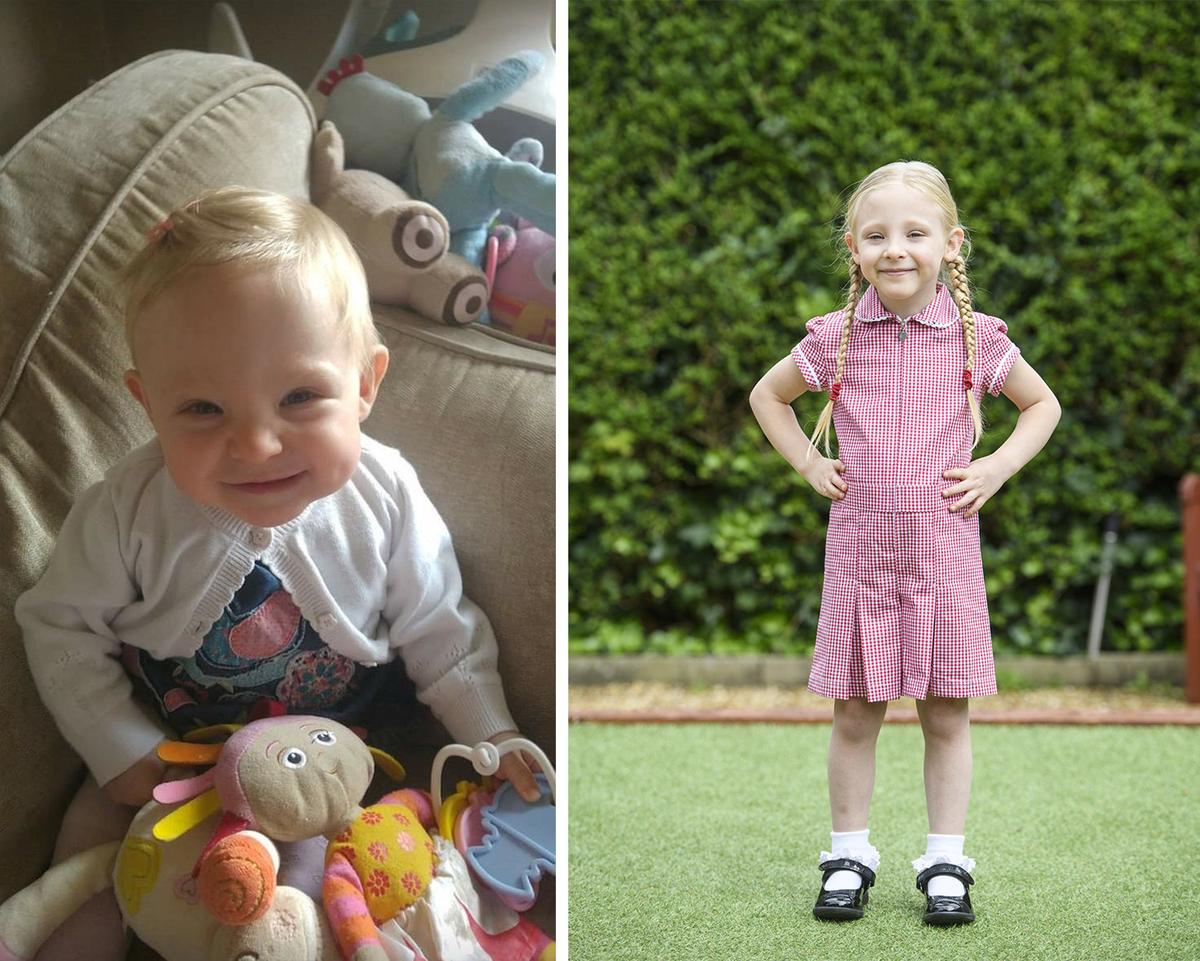 (Left) Darcey Clegg as a baby; (Right) Darcey now as a healthy 4-year-old. (SWNS)