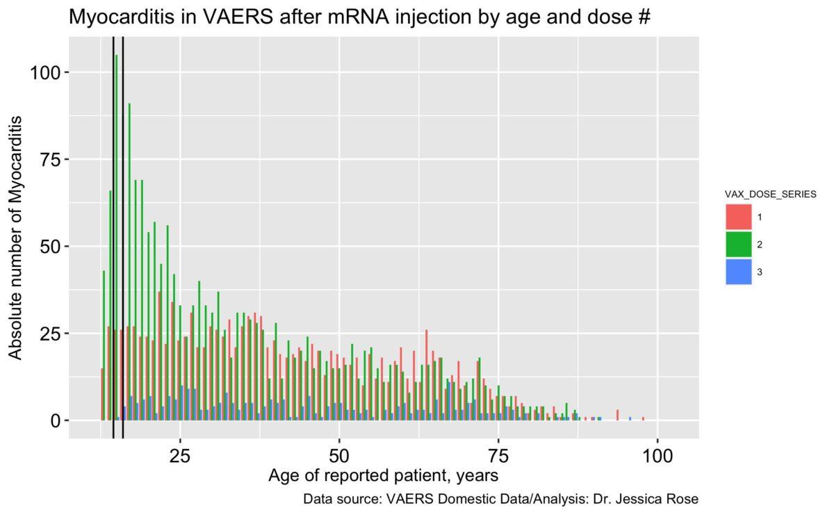 A graph showing age against the absolute number of myocarditis reports filed to VAERS according to doses 1, 2, and 3 of the COVID-19 vaccines. (Jessica Rose)