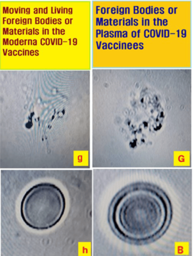 Comparisons of foreign materials observed in the Moderna vaccine magnified 400x and in plasma samples from vaccinated patients who received one or more doses of Moderna mRNA COVID-19 vaccine. (“Foreign Materials in Blood Samples of Recipients of COVID-19 Vaccines” in the International Journal of Vaccine Theory, Practice, and Research.)