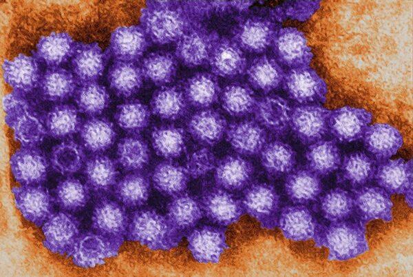 A transmission electron micrograph shows norovirus particles in an undated file photo. (Charles D. Humphrey/US Centers for Disease Control and Prevention)