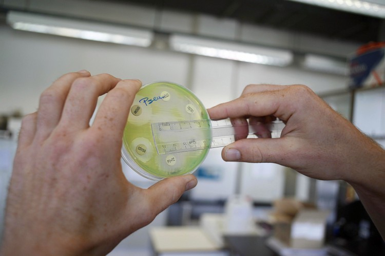 A researcher holding a petri dish at the microbiology lab of the Universitair Ziekenhuis Antwerpen in 2010, after a man died in Belgium following infection by a super bug, NDM-1, that is resistant against almost every antibiotic. (Jorge Dirkx/AFP/Getty Images)