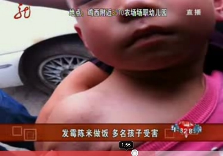 A sick child is rushed to the hospital after eating moldy rice. (Screenshot from Youtube)