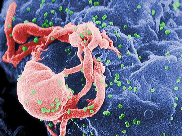 Scanning electron micrograph of HIV-1 (in green) budding from cultured lymphocyte. Multiple round bumps on cell surface represent sites of assembly and budding of virions.  (Public domain)
