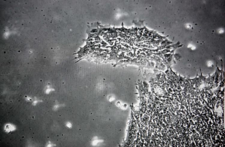 A colony of human embryonic stem cells is seen on a computer monitor that is hooked up to a microscope. (Darren Hauck/Getty Images)