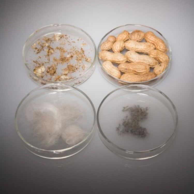 The most common childhood food allergy causes are peanuts, milk, and shellfish. (Photos.com)