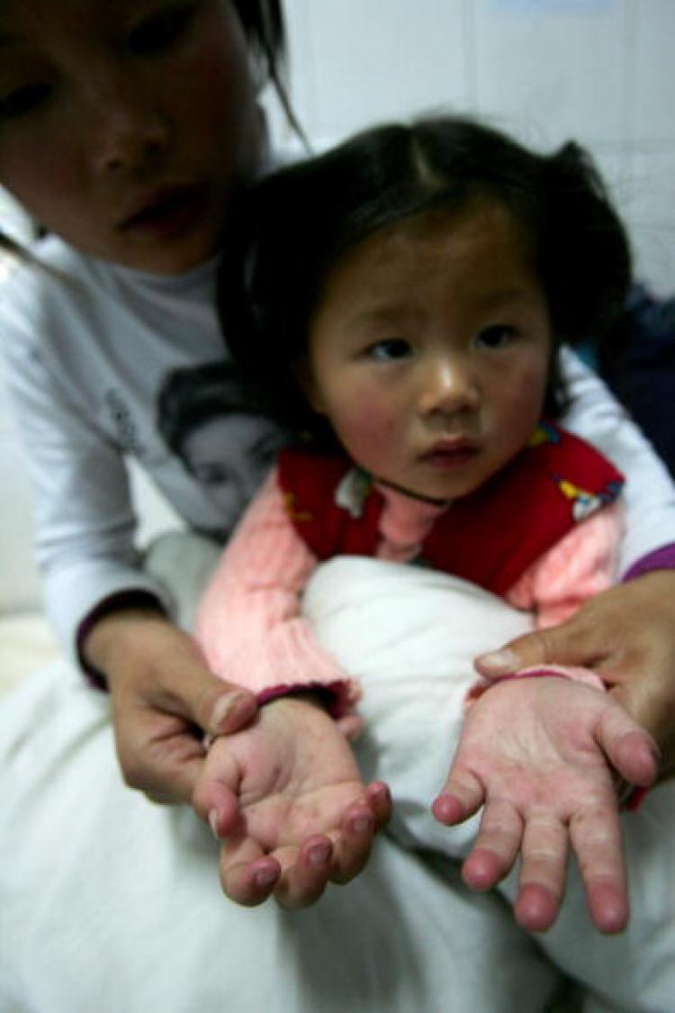 CONCERN: A 2-year-old reports for a check-up with suspicious symptoms. (Getty Images)