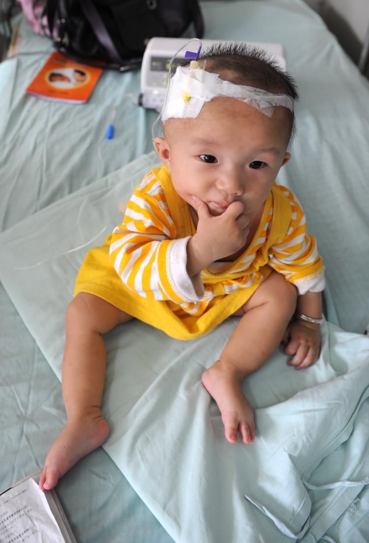 A baby who suffers from kidney stones after drinking tainted milk powder, gets IV treatment at the Chengdu Children's Hospital on September 22, 2008 in Chengdu of Sichuan Province, China. (China Photos/Getty Images)