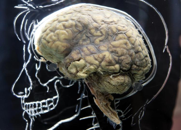 BRAIN: A human brain in the Real Brain Exhibit in Bristol, England. (Matt Cardy/Getty Images)