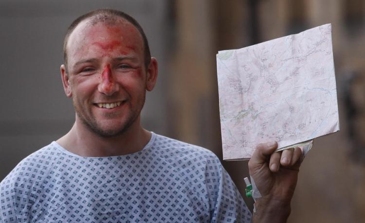 GLASGOW, UNITED KINGDOM - JANUARY 30: Adam Potter, 36, from Glasgow, who fell almost 1,000ft (305m) from the summit of Britain's highest mountain, poses while recovering at the Southern General hospital on January 30, 2011 in Glasgow, Scotland. (Getty Unedited)