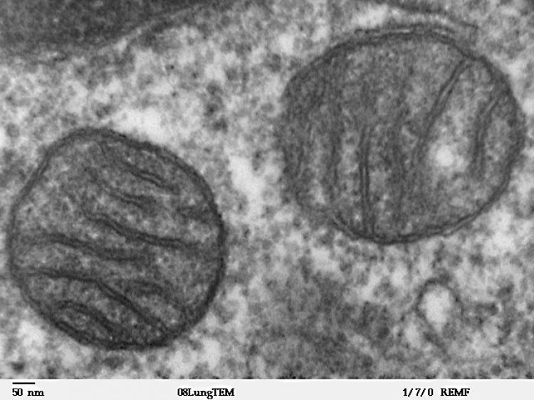 MITOCHONDRIA: Transmission electron microscope image of a thin section cut through an area of mammalian lung tissue showing two mitochondria. Recent research has found that a protein that localizes on the surfaces of mitochondria plays a role in sperm formation. (Louisa Howard/Wikimedia Commons)