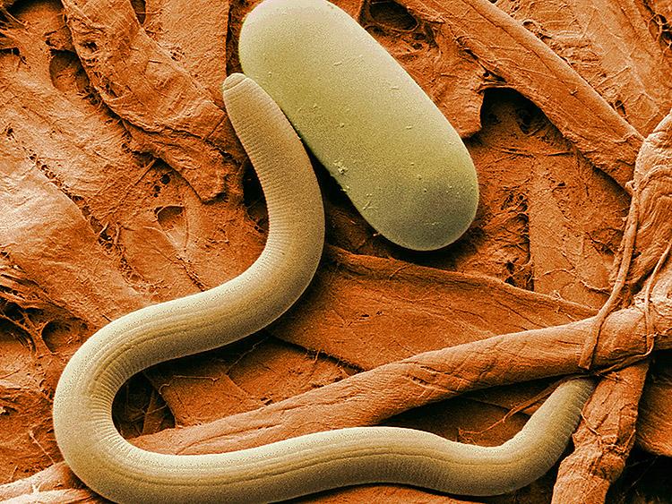 ROUNDWORM: Photo of a Soybean cyst nematode and its egg, magnified 1,000X. A yellow dye used in staining misfolded proteins associated to Alzheimer's disease can boost the lifespan of roundworms by 78 percent. (Agricultural Research Service)