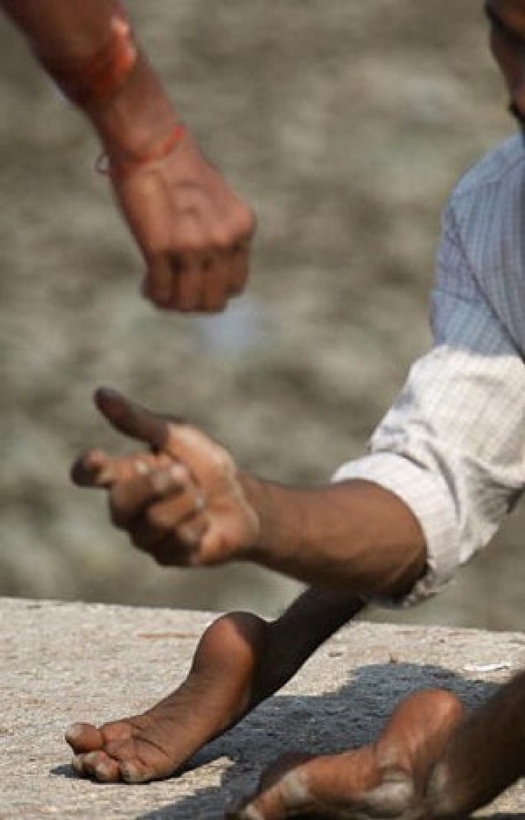 A disabled beggar begs for alms.  (Sajjad Hussain/AFP/Getty Images)