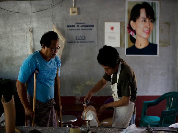 IMPACT: A Burmese landmine victim watches as a worker prepares an artificial limb at the Mae Tao clinic in Northwest Thailand. (Nicolas Asfouri/AFP/Getty Images)