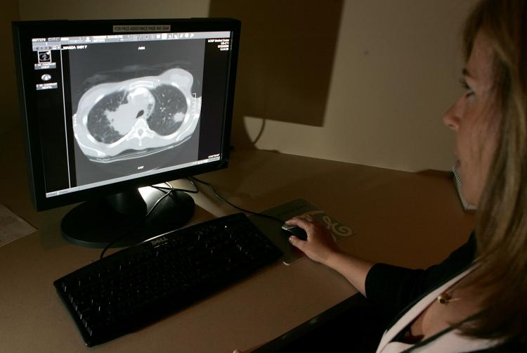 Lung cancer screenings that utilize a type of computed tomography (CT) scan could detect lung cancer in its early stages and reduce deaths by as much as 20 percent, according to recent research. Above, radiology technologist Mary McPolin looks at a CT scan of a lung with a tumor at the UCSF Comprehensive Cancer Center. (Justin Sullivan/Getty Images)