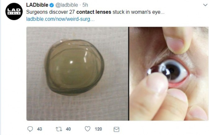 Doctors Find Missing Contact Lenses In Womans Eye The Epoch Times