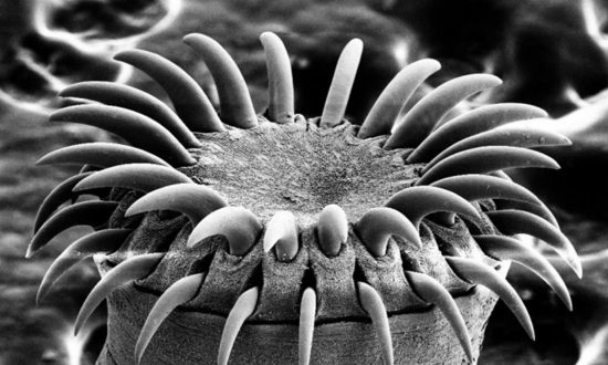Teenager Dies After Tapeworm Infection Left His Brain Riddled With Cysts