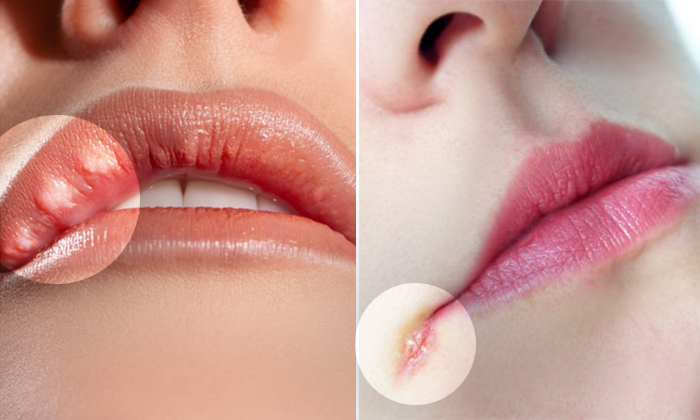 10 things your lips say about your health—tingling lips may signify a strok...