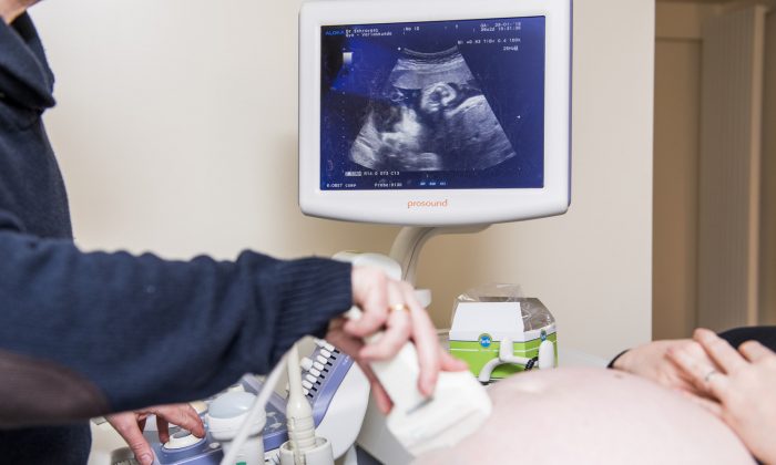 In an illustration photo, a doctor performs an ultrasound on a pregnant woman during her visit to a gynecologist. (Jennifer Jacobs/AFP/Getty Images)