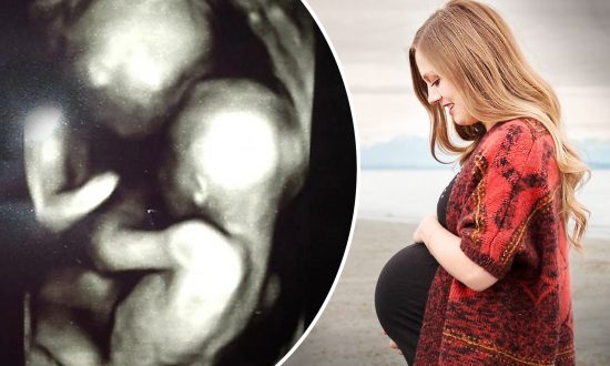 Pregnant Woman’s Ultrasound Reveals ‘High Risk’ Momo Twins–but She Rejects Option to Abort